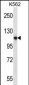 PLEKHM1 Antibody (N-term)